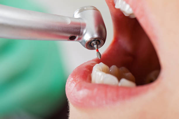 Best Emergency Cosmetic Dentistry in Bowling Green, FL